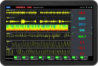 Biosignal Analysis & Perioperative Outcome Research (BAPOR) Lab.